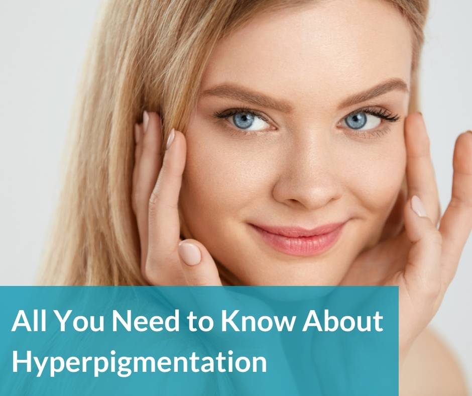 hyperpigmentation