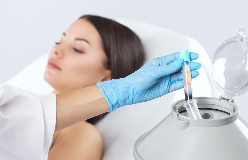 what is PRP therapy