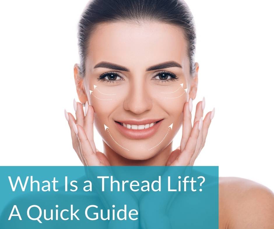 what is a thread lift