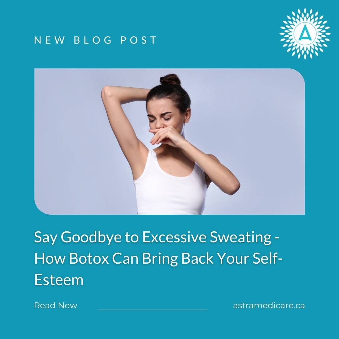 botox for sweating