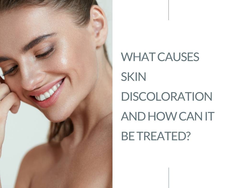 skin discolouration