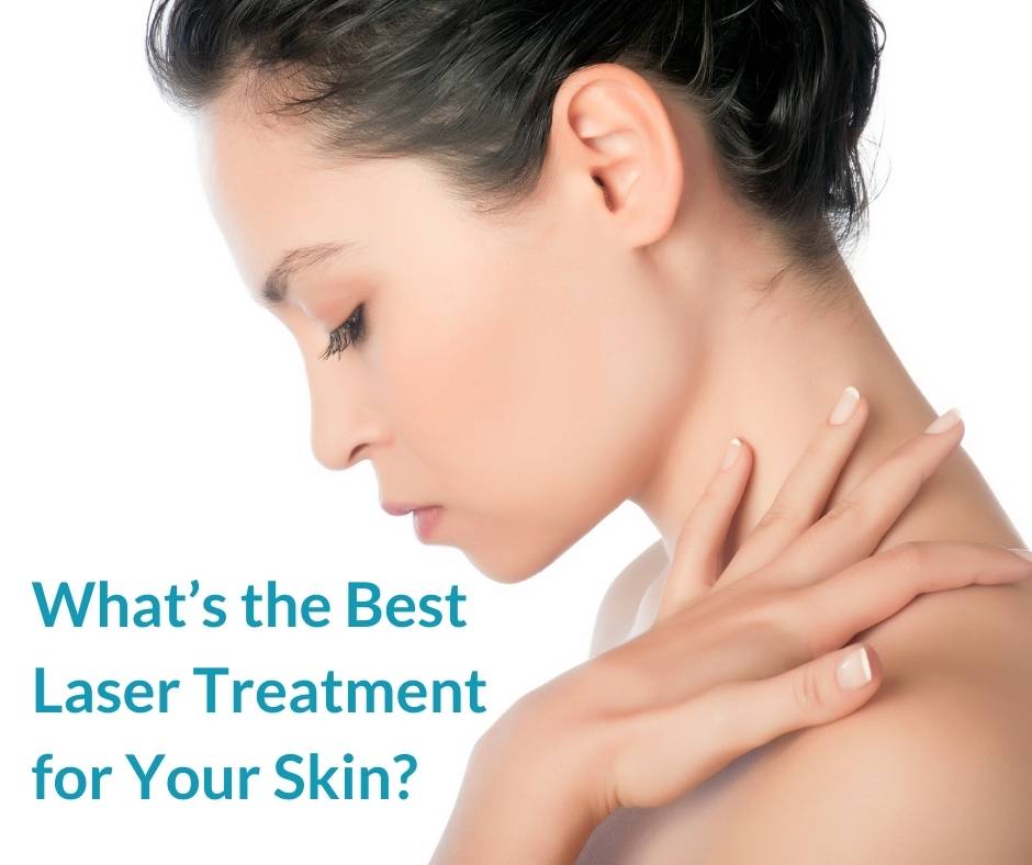 Best Laser Treatment for Your Skin